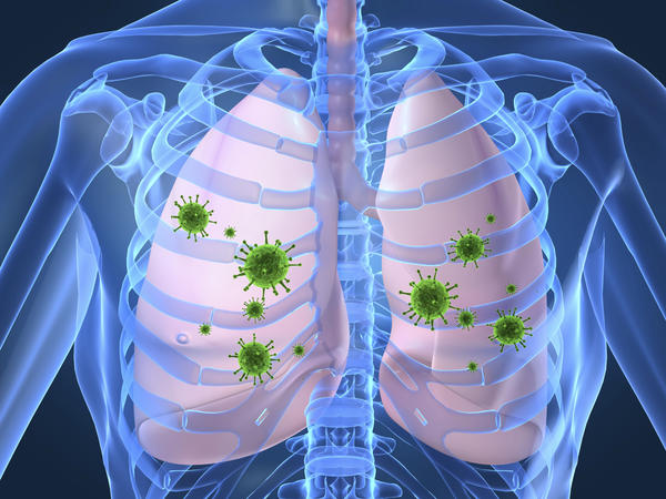 Tuberculosis