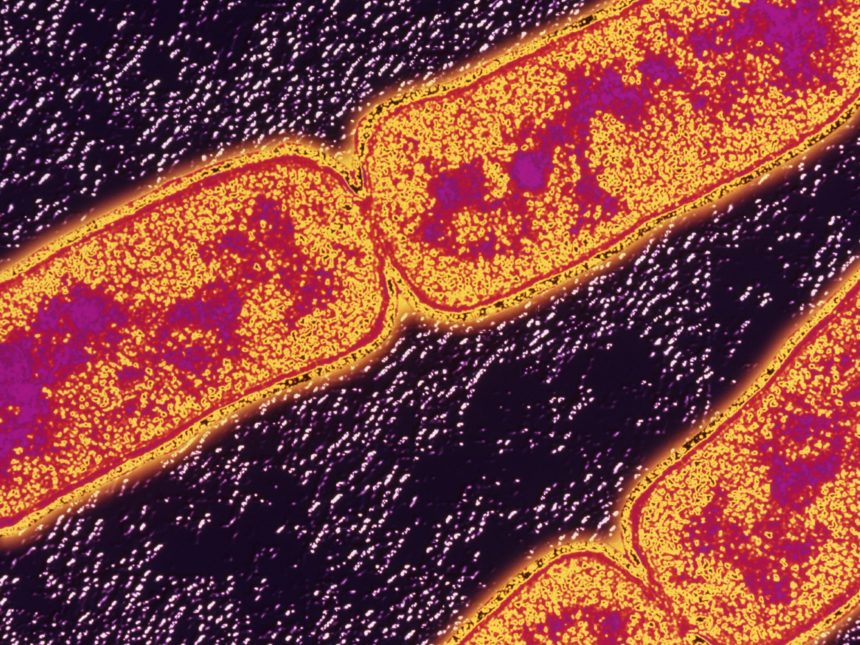 tuberculosis_G_680790387-860x645