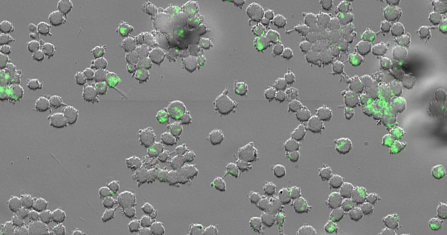 Mycobacterium tuberculosis (green) inside human immune cells known as macrophages. (Credit: Av-Gay Lab)