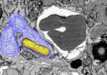Salmonella bacteria (yellow) in a vacuole (blue) in a macrophage. (Image: University of Basel, Biozentrum)