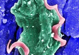 Tmu_Burrows et al_MORTHA