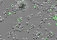 Mycobacterium tuberculosis (green) inside human immune cells known as macrophages. (Credit: Av-Gay Lab)