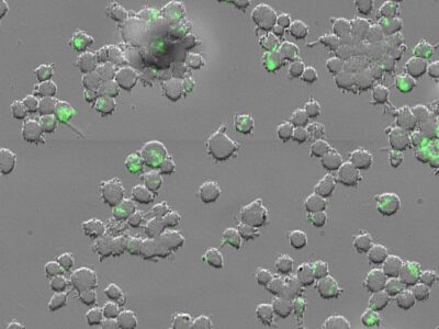 Mycobacterium tuberculosis (green) inside human immune cells known as macrophages. (Credit: Av-Gay Lab)